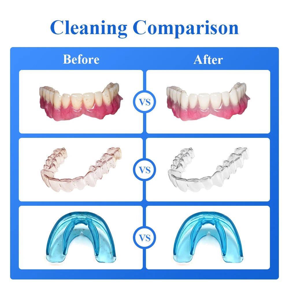 Tullker Household Ultrasonic Retainer Cleaner for Denture Jewelry Braces Cleaning with UV Light