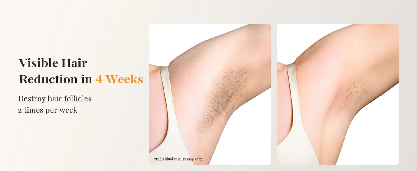 Laser Hair Removal IPL with Ice Cooling, 9 Energy Levels Unlimited Light Pulses for Face Armpits Leg Body Permanent Hair Removal