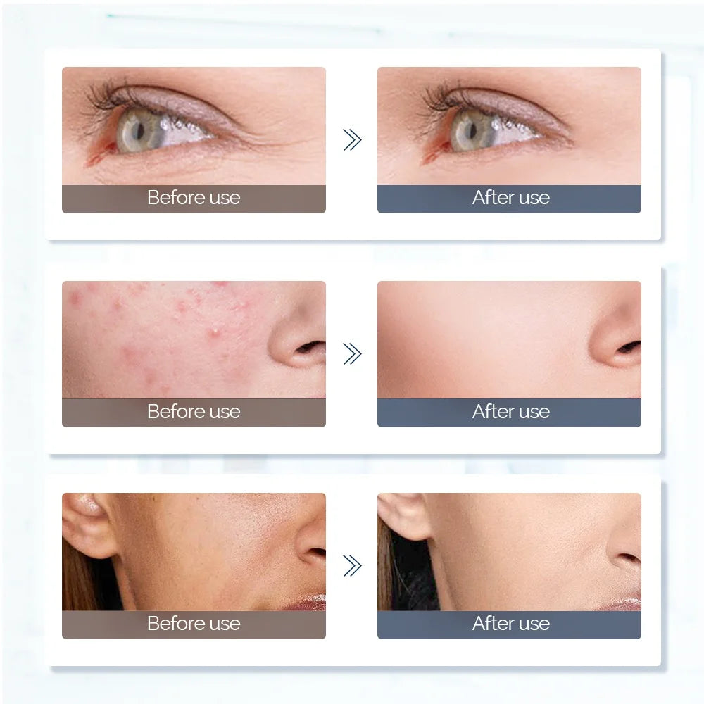 Foreverlily Face Neck Silicone LED Mask 7 Colors LED Light Photon Red Light Therapy 3D Flexible Facial Mask Anti-Ance Skin Care