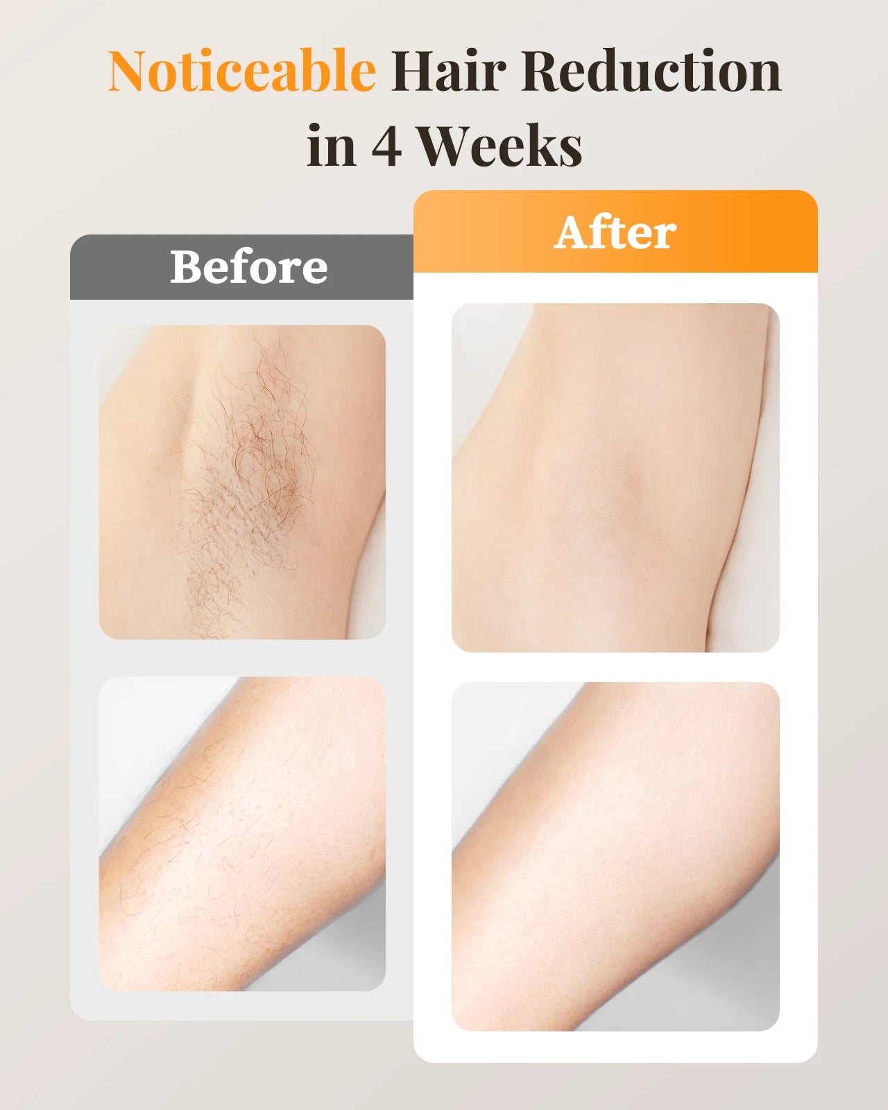 Laser Hair Removal IPL with Ice Cooling, 9 Energy Levels Unlimited Light Pulses for Face Armpits Leg Body Permanent Hair Removal