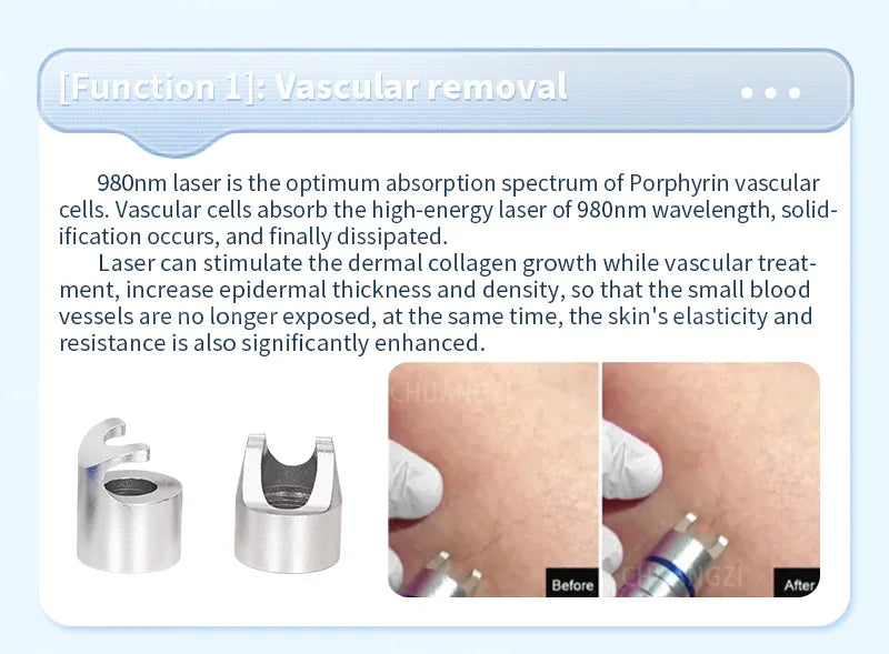 980Nm Laser Diode Vascular Spider Varicose Vein Removal Machine Treatment Fungi Physiotherapy For Nail Lipolisi Commercial Salon