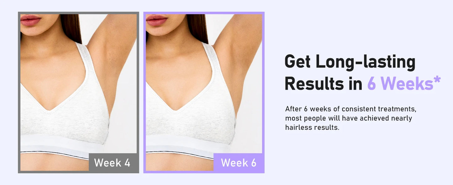 Hair Removal Laser With 9 Energy Levels for Women Permanent Hair Remover 999,900+ Quick Flash Painless IPL Hair Remover Device