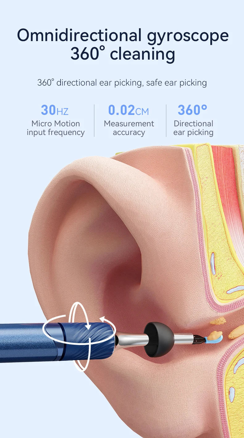 Ear Wax Removal 2-in-1 Visual Otoscope Ear Cleaner Tweezers with 6 Ear Spoon Earwax Removal Kit with Light  Ear Cleaner