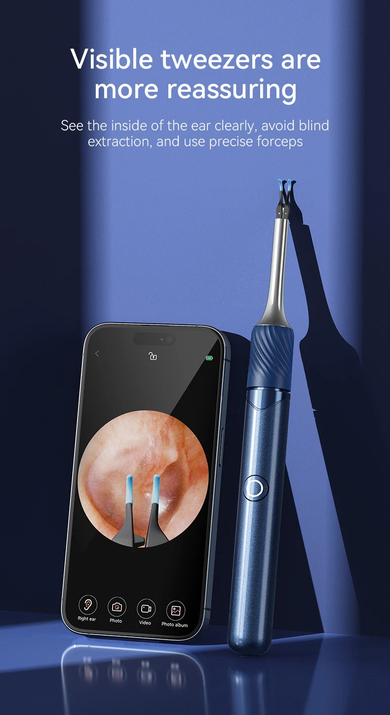 Ear Wax Removal 2-in-1 Visual Otoscope Ear Cleaner Tweezers with 6 Ear Spoon Earwax Removal Kit with Light  Ear Cleaner