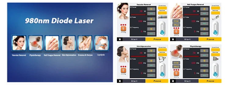 980Nm Laser Diode Vascular Spider Varicose Vein Removal Machine Treatment Fungi Physiotherapy For Nail Lipolisi Commercial Salon