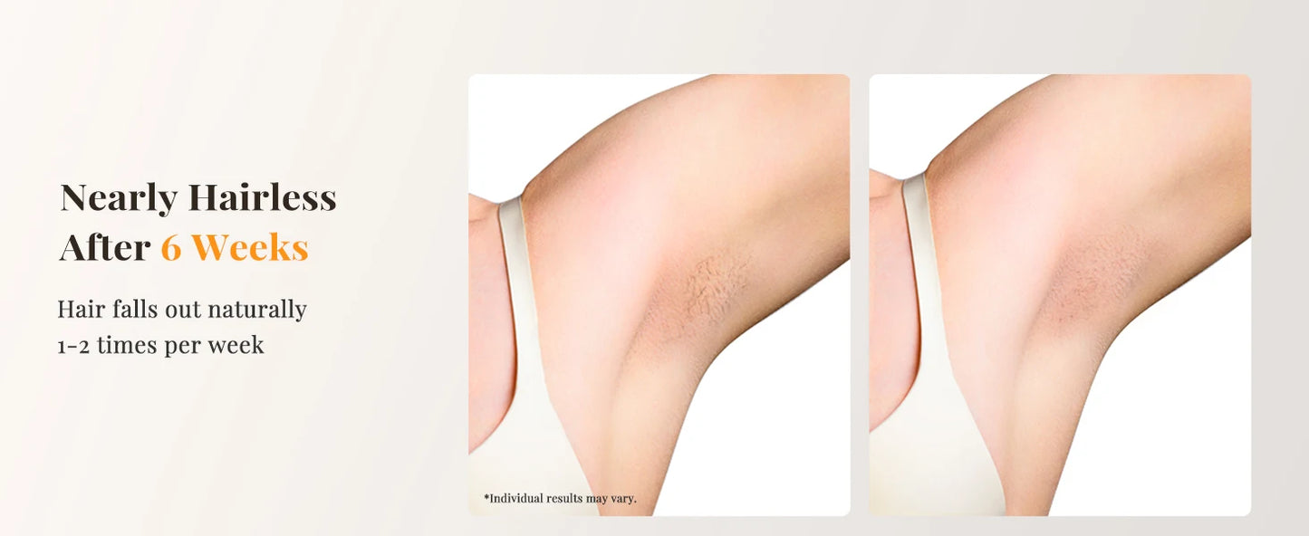 Laser Hair Removal IPL with Ice Cooling, 9 Energy Levels Unlimited Light Pulses for Face Armpits Leg Body Permanent Hair Removal