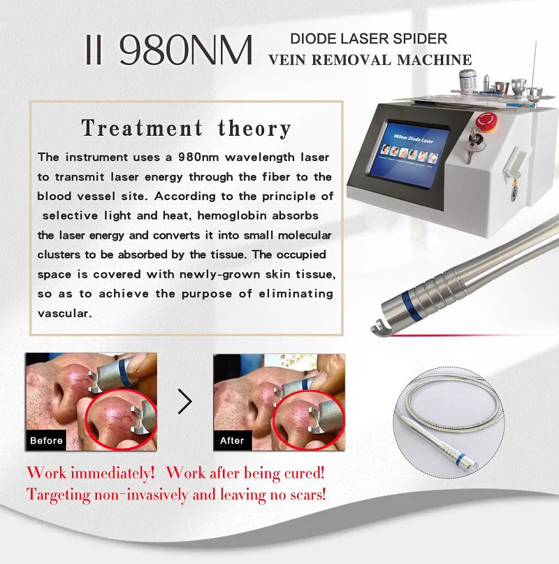 980Nm Laser Diode Vascular Spider Varicose Vein Removal Machine Treatment Fungi Physiotherapy For Nail Lipolisi Commercial Salon
