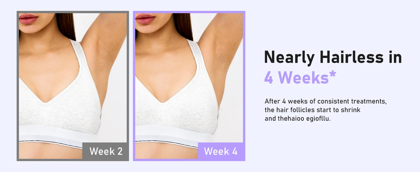 Hair Removal Laser With 9 Energy Levels for Women Permanent Hair Remover 999,900+ Quick Flash Painless IPL Hair Remover Device