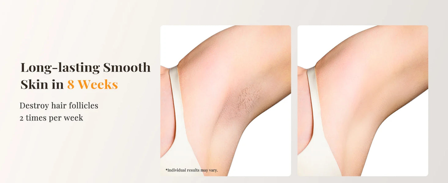 Laser Hair Removal IPL with Ice Cooling, 9 Energy Levels Unlimited Light Pulses for Face Armpits Leg Body Permanent Hair Removal