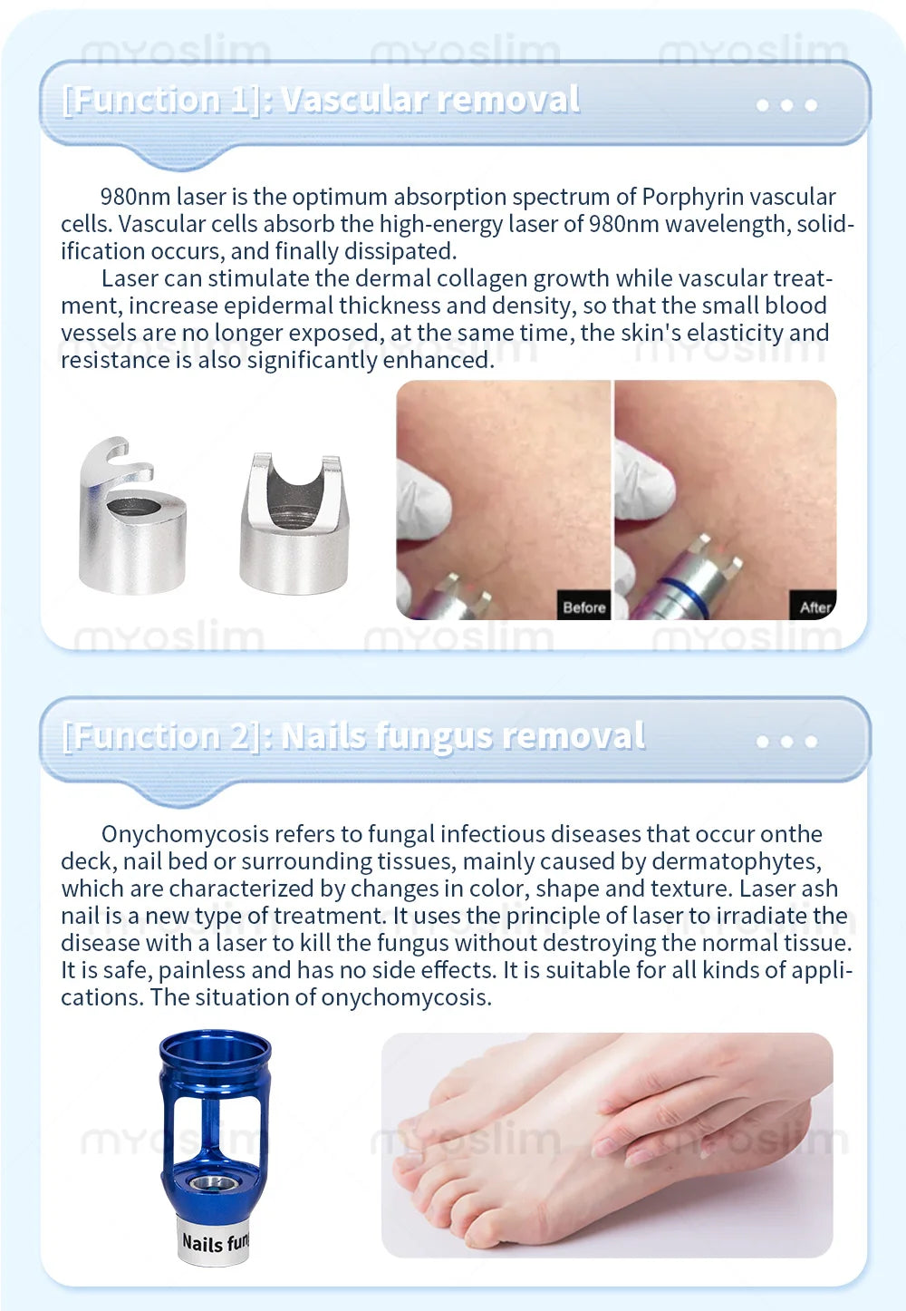 980nm 5 in 1 Laser Diode Vascular Spider Varicose Vein Remover Nail Fungus Treatment Physical Therapy Eczema Removal