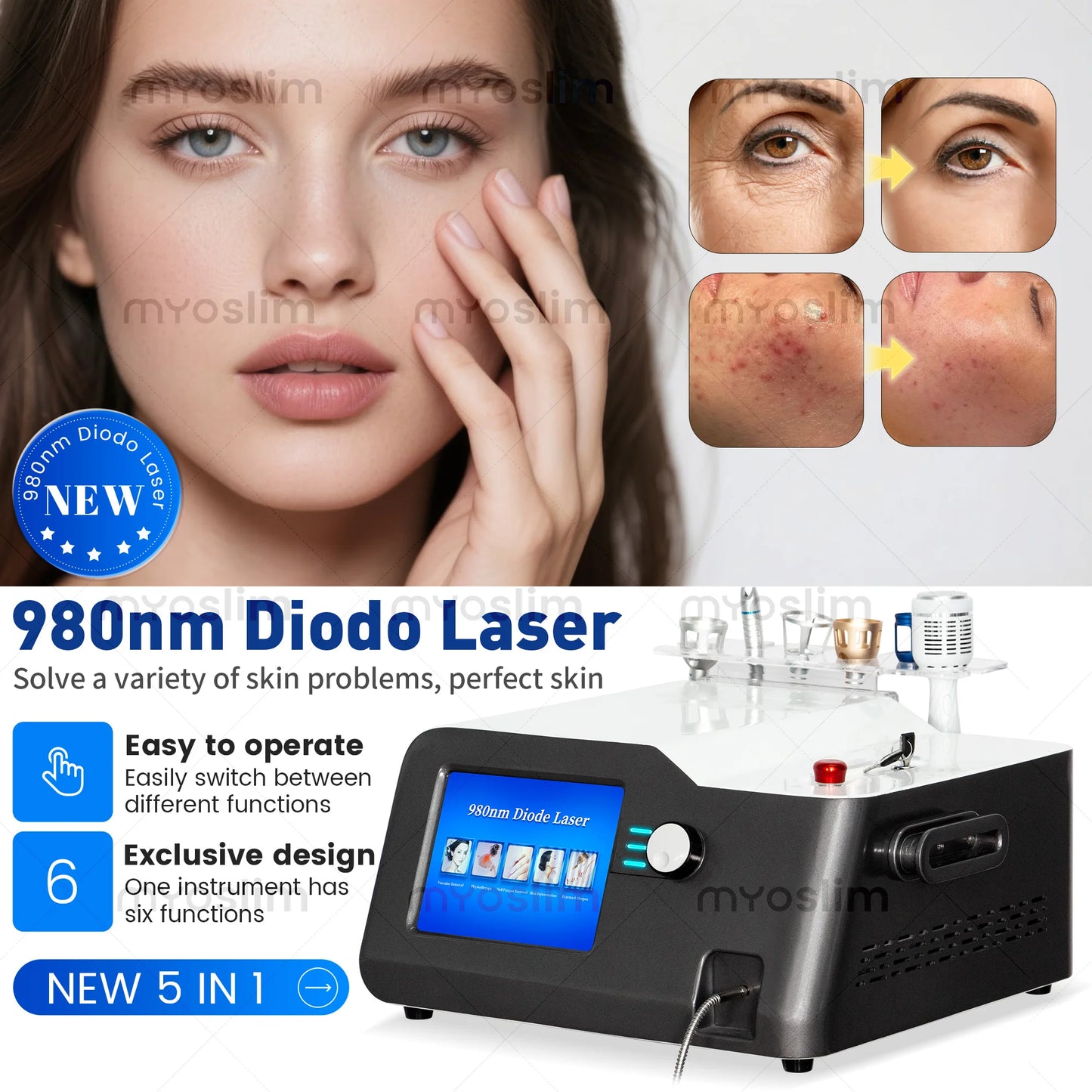 980nm 5 in 1 Laser Diode Vascular Spider Varicose Vein Remover Nail Fungus Treatment Physical Therapy Eczema Removal